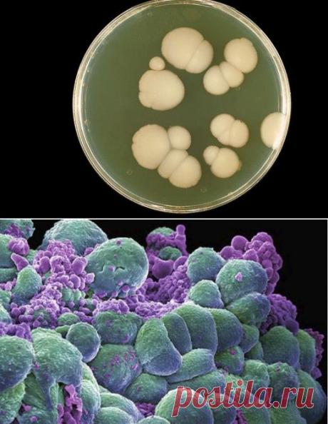 Тулио Симончини: Рак излечимое грибковое заболевание