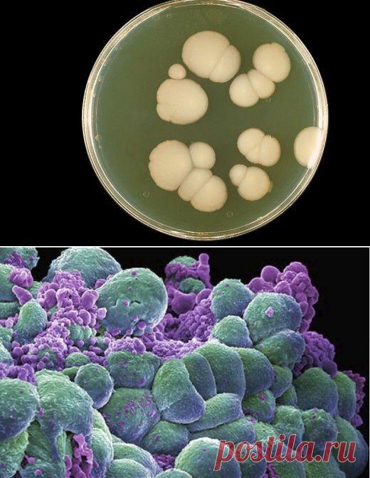 Тулио Симончини: Рак излечимое грибковое заболевание