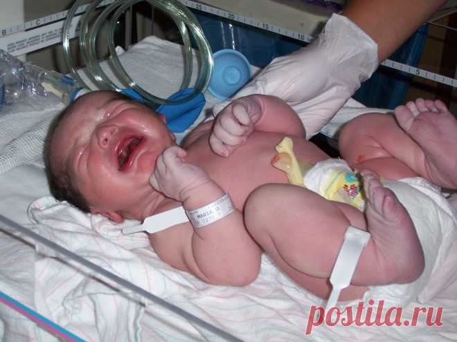 Лечение детей с галактоземией