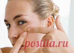 Чистотел от прыщей. | Советы Народной Мудрости