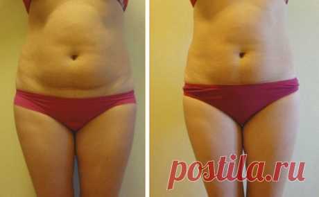 Благодаря аптечному средству за 37 рублей: Я убрала жир с живота за 1 месяц! | Худеем Дома | Яндекс Дзен