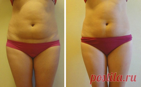 Благодаря аптечному средству за 37 рублей: Я убрала жир с живота за 1 месяц! | Худеем Дома | Яндекс Дзен
