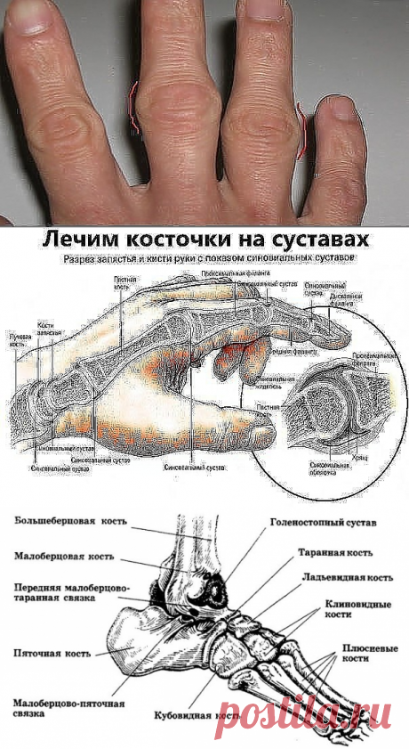 (10) Одноклассники