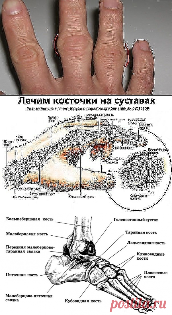 (10) Одноклассники