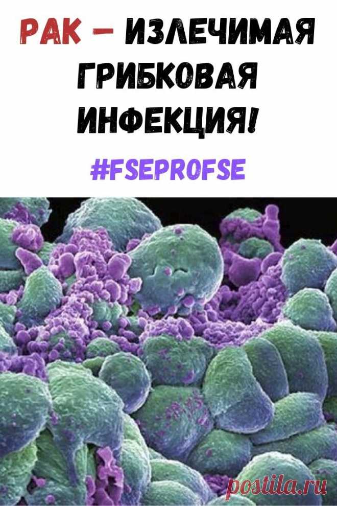 Очень похоже на то, что медицинская мафия использует слово «рак», как обманку для последующего массового убийства людей с помощью радио- и химиотерапии. Процедуры эти очень дорогие, но работают хорошо – убивают абсолютно все #рак #онкология #лечение #здоровье #fseprofse