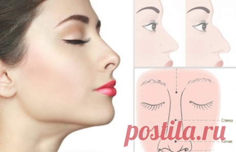 Ринопластика - Секреты.нет