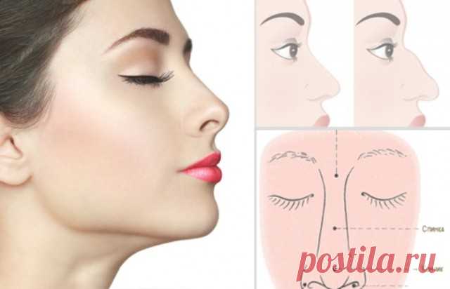 Ринопластика - Секреты.нет