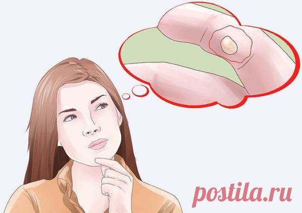 (+1) тема - Домашние средства от незначительных ожогов | Полезные советы