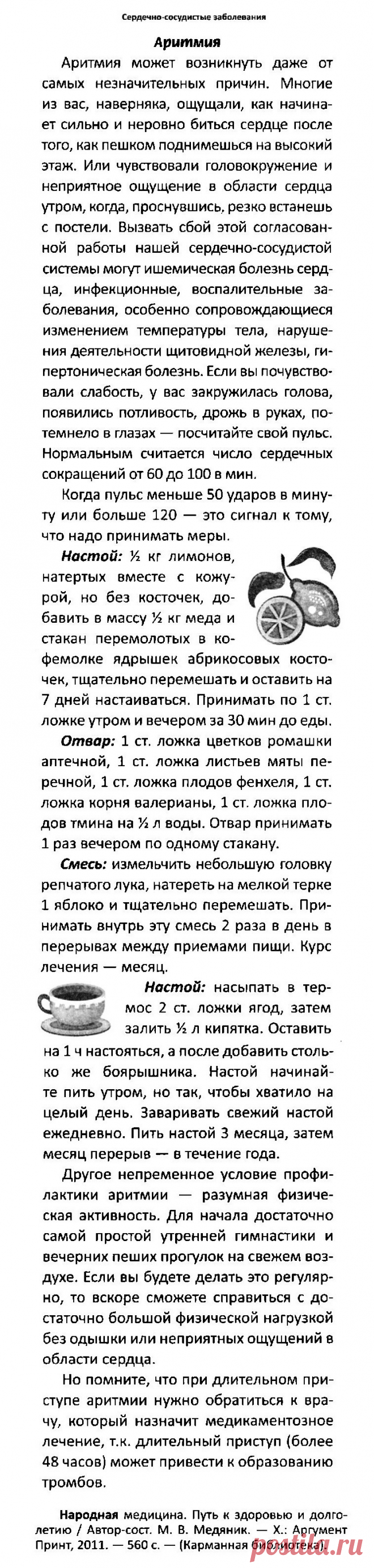 Аритмия