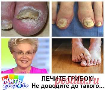 Елена Малышева: "Как я избавилась от грибка ногтей"