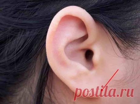 Отсутствие уха и/или мочки  (код МКБ-10; код МКБ-11): описание, причины, симптомы, как лечить | Клиника лечения боли: врачи онлайн