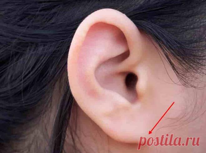 Отсутствие уха и/или мочки  (код МКБ-10; код МКБ-11): описание, причины, симптомы, как лечить | Клиника лечения боли: врачи онлайн