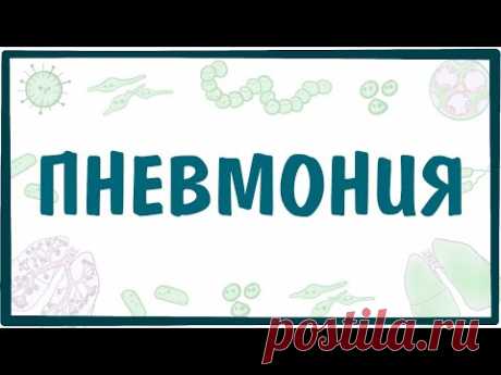ПНЕВМОНИЯ — причины, симптомы, патогенез, диагностика, лечение