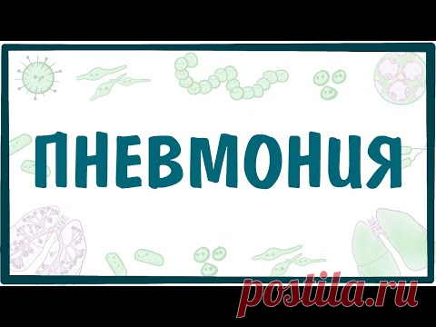 ПНЕВМОНИЯ — причины, симптомы, патогенез, диагностика, лечение