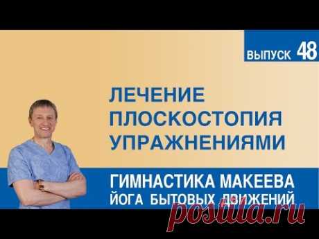 Лечение плоскостопия упражнениями