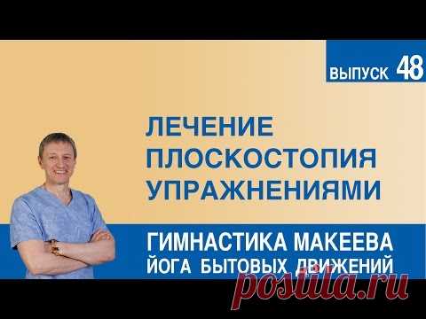 Лечение плоскостопия упражнениями