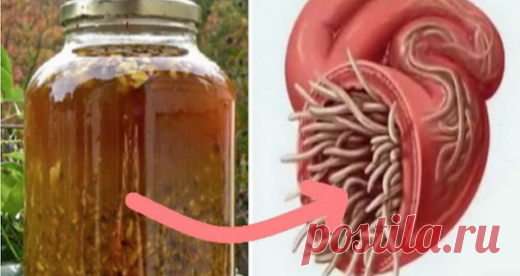 Приготовьте естественный антибиотик, который лечит любую инфекцию в теле и убивает паразитов Приготовьте этот естественный антибиотик и наслаждайтесь оптимальным здоровьем!