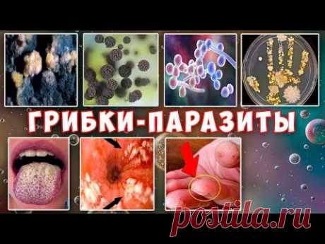 Грибковые поражения. Лечение кандидоза и др. грибковых инфекций. Дрожжи. Плесень.