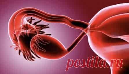 Оофорит. Воспаление яичников  (код МКБ-10; код МКБ-11): описание, причины, симптомы, как лечить  | Клиника лечения боли: врачи онлайн