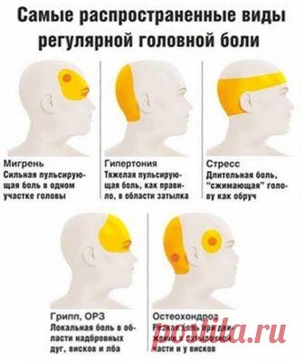 Давление или мигрень? 7 причин головной боли и что делать Говорят, голова болит у всех, но у всех она болит по-разному. А можно ли самостоятельно определить, какой вид головной боли мешает жить? Отвечает профессор кафедры госпитальной терапии РНИМУ им. Пирогова Александр Карабиненко, aif...