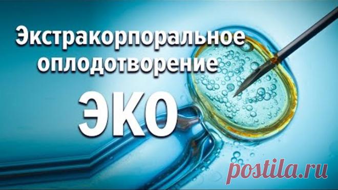 Экстракорпоральное оплодотворение - ЭКО. Татьяна Алексеевна Малышева