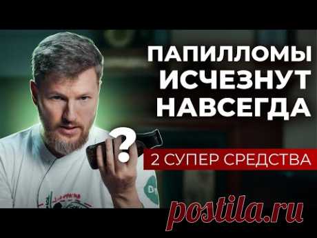 Как избавиться от папиллом и бородавок навсегда? 2 средства для идеальной кожи