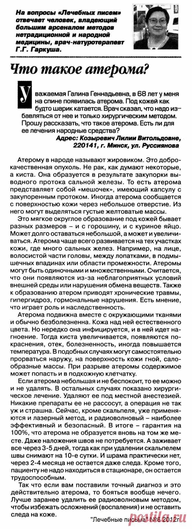 Что такое атерома (жировик)