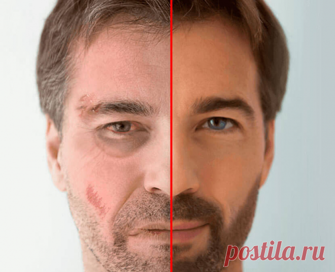 Алкофин - Препарат от алкогольной зависимости
Навсегда избавляет
от привычки пить после первого курса Алкофин

Восстанавливает здоровье
и возвращает к нормальной
жизни даже в крайней стадии алкоголизма

Нейтрализует
похмельный
синдром

Защищает от ломки
и срывов