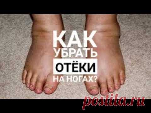 Как убрать отёки на ногах? Домашние способы и аптечные мази от отёков.