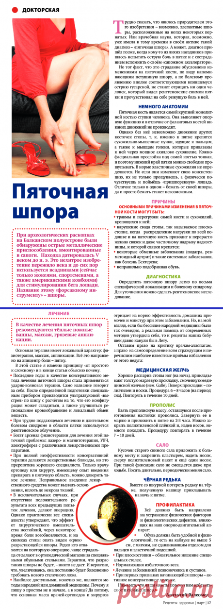 Пяточная шпора