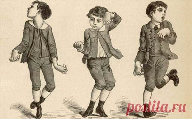 Хорея Гентингтона: история открытия лекарства | Краше Всех