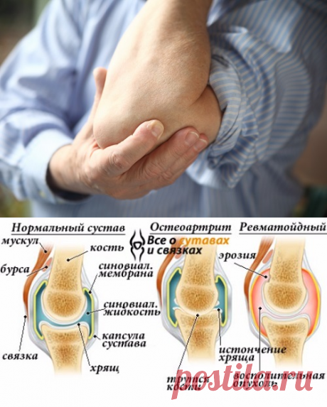 Боли в суставах: причины и лечение народными средствами