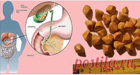 Как естественно растворить желчные камни! - Журнал для женщин Стоит воспользоваться советом! Желчные камни — это небольшие камни, обнаруженные в желчном пузыре, небольшом органе, который играет главную роль в хранении желчи, сделанной печенью. Лица, которые испытывали сильную боль в верхнем брюшном пространстве в течение длительных или иногда коротких периодов времени, должны сами проверить желчные камни. Боль в основном проявляется в определенных областях тела, таких […]