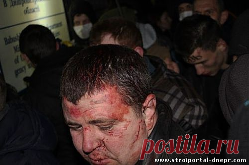 Днепр: Не ответили «Героям слава» - получите сломанные ребра - 18 Марта 2014 - Рекламно-информационный портал «Прораб Днепропетровщины