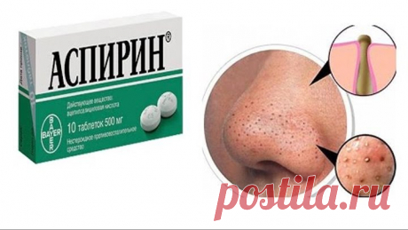 МАСКА для ЛИЦА с АСПИРИНОМ. Избавляемся от черных точек, жирного блеска и сужаем поры на лице