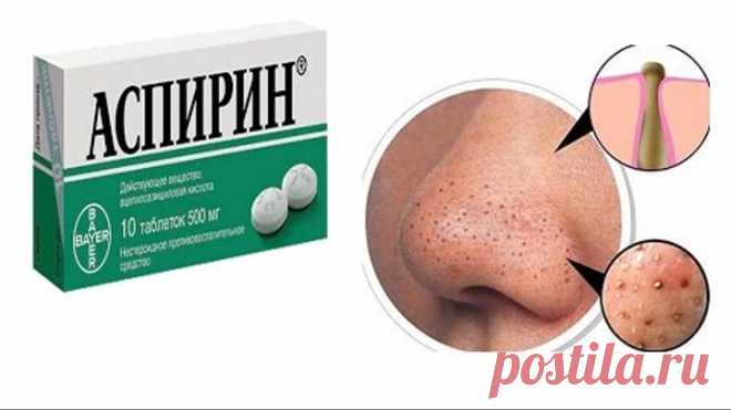 МАСКА для ЛИЦА с АСПИРИНОМ. Избавляемся от черных точек, жирного блеска и сужаем поры на лице