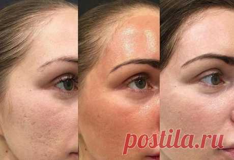 На меня стоит потратиться: 5 средств, которые нужны каждой