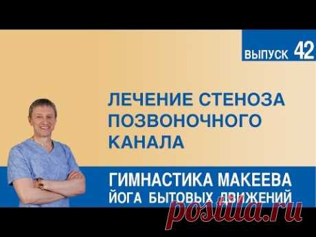 Лечение стеноза позвоночного канала