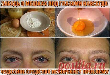глазки