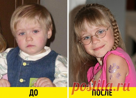 12 фото малышей до усыновления и после, которые пробирают до кома в горле
