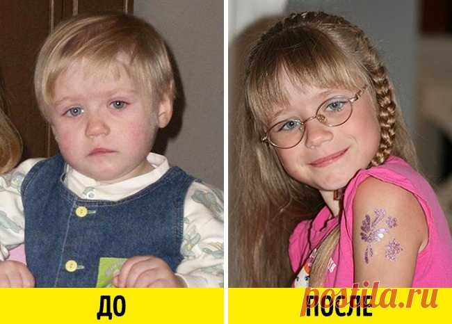12 фото малышей до усыновления и после, которые пробирают до кома в горле