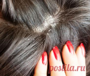 10 признаков, которые говорят, что организму не хватает витаминов — Домашние заботы