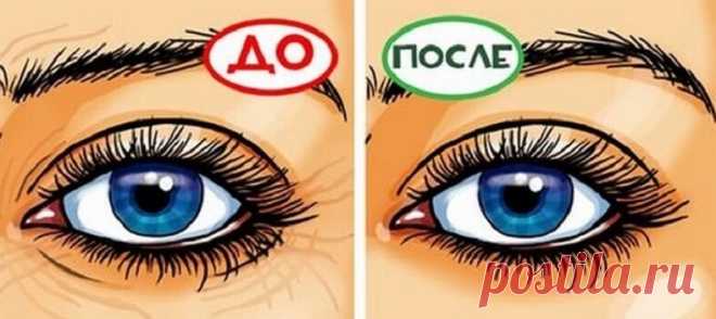 В течение 5 дней она прикладывала куркуму вокруг глаз! И вот что случилось! Куркума является невероятно полезной специей, широко используется в индийской кухне. Она обладает ярко выраженным, неповторимым ароматом и характерным цветом, а также удивительными свойствами для здоровья.