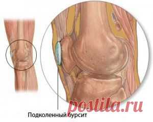 Причины и лечение боли в коленях