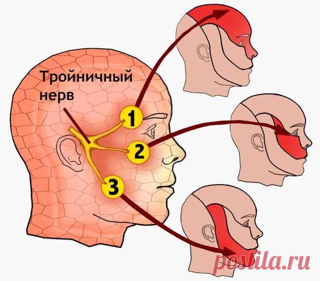 Забудете про гайморит и проблемы тройничного нерва - без лекарств! Эффективность применения удивит, ведь не каждое средство способно на такой результат! Ну, кто не знает про чеснок?! Его целительные способности уже