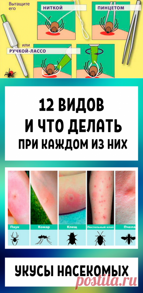 Укусы насекомых: 12 видов и что делать при каждом из них в домашних условиях + народные рецепты