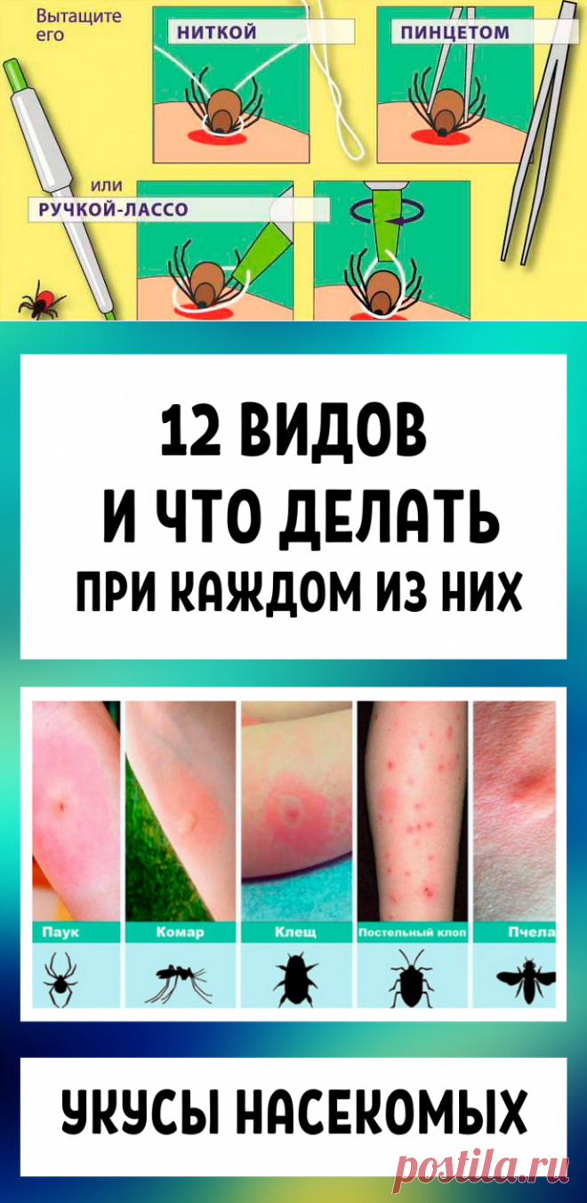 Укусы насекомых: 12 видов и что делать при каждом из них в домашних условиях + народные рецепты
