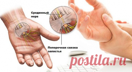 8 ЕСТЕСТВЕННЫХ СПОСОБОВ ОБЛЕГЧИТЬ БОЛЬ В ЗАПЯСТЬЕ — Копилочка полезных советов