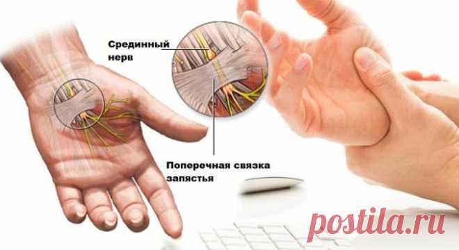 8 ЕСТЕСТВЕННЫХ СПОСОБОВ ОБЛЕГЧИТЬ БОЛЬ В ЗАПЯСТЬЕ — Копилочка полезных советов