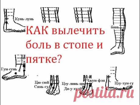 Как вылечить боль в стопе и пятке?